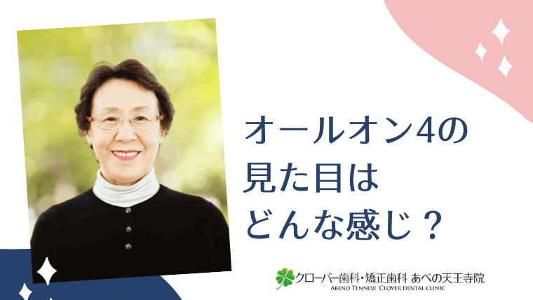 オールオン4の見た目はどんな感じ？