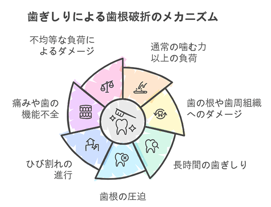 歯ぎしりによる歯根破折